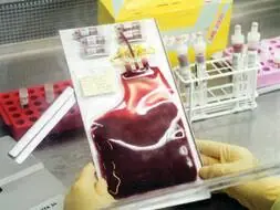 ¿Sirve de algo guardar el cordón umbilical del bebé?