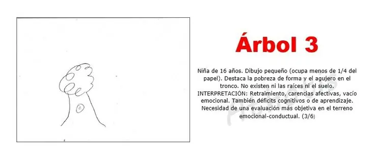 Arbol