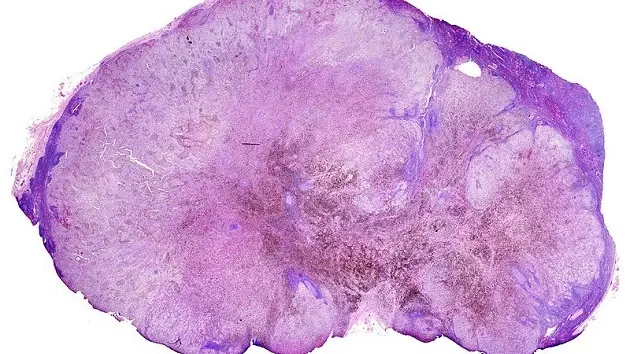 de forma natural Una científica uruguaya frena la mestást