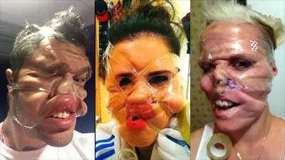 Una moda monstruosa: atarse la cara con cinta adhesiva