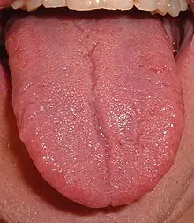 T! T!