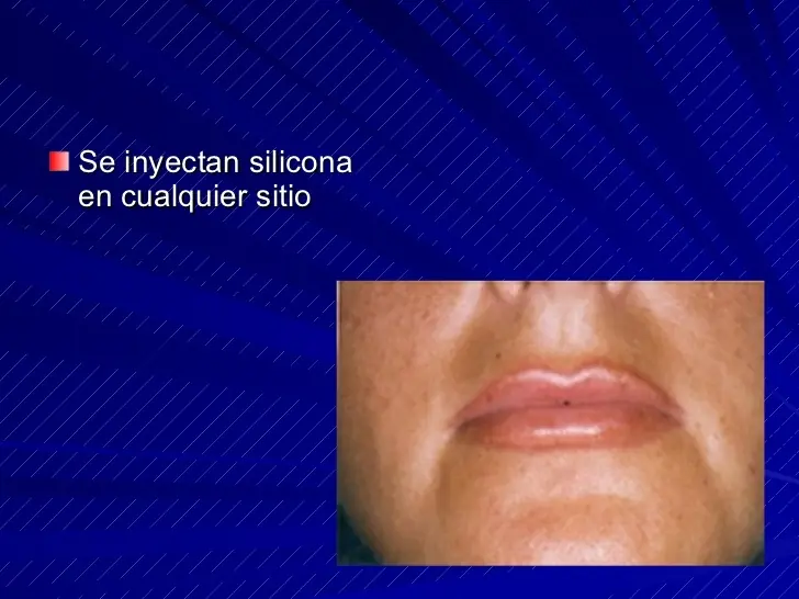 quejas