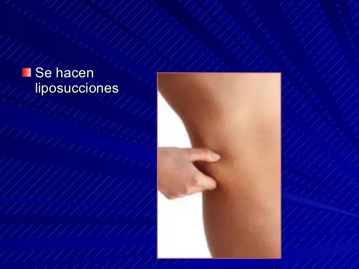 mujer