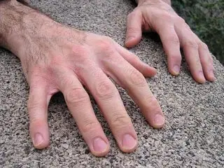 FOP