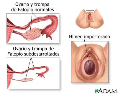 Menstruacion