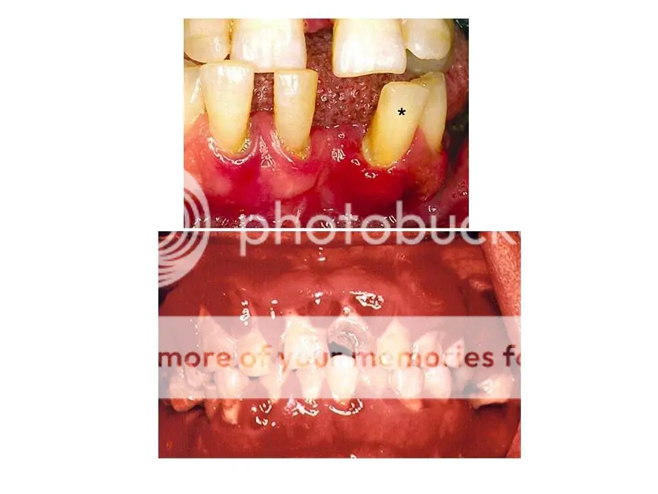 BUCODENTAL