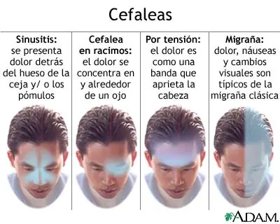 Como quitar el dolor de cabeza