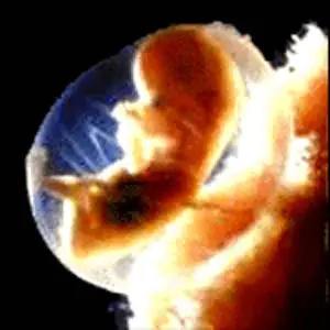 pregnyl