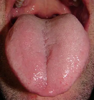 Las 30 muertes mas absurdas de la historia