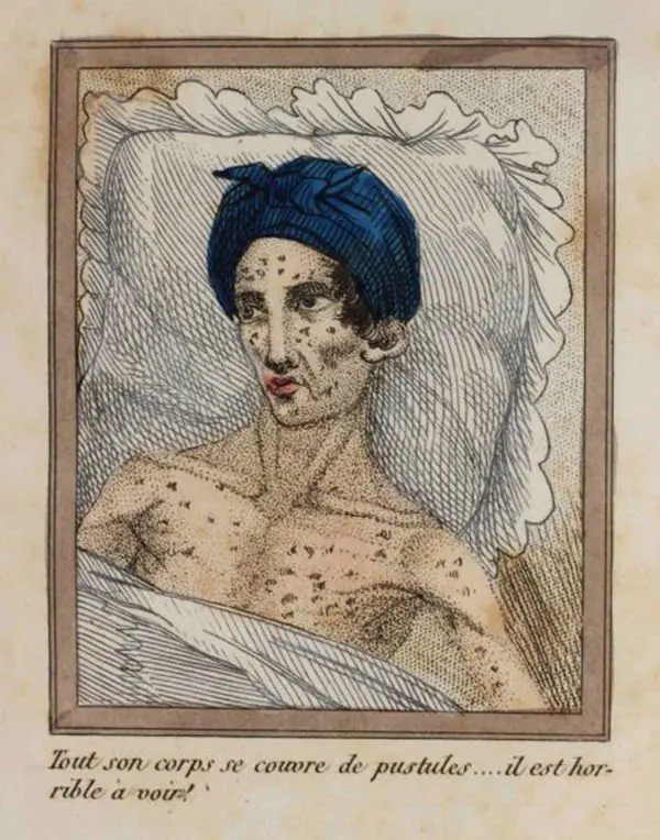 Los horrorosos efectos del FAP ilustrados en un libro de 183