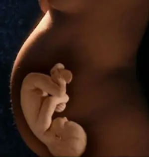 Si Quieren ser Padres, Sabes lo Que es la COLESTASIS????