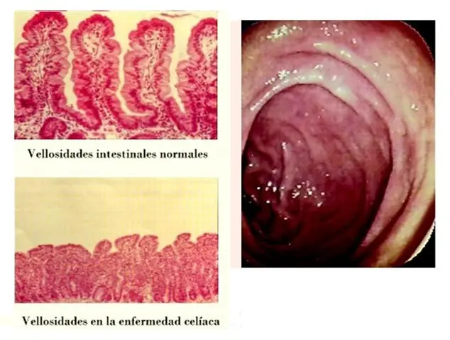 analisis