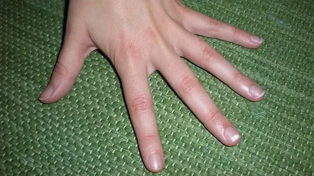 ¿Tenés manchitas blancas en las uñas? Te digo por qué.