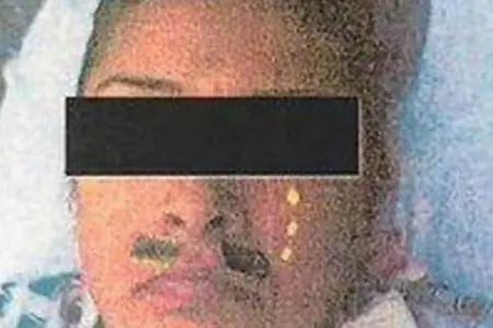 medico gracioso, hace bigotes a los pacientes