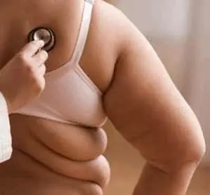 La obesidad y sus problemas