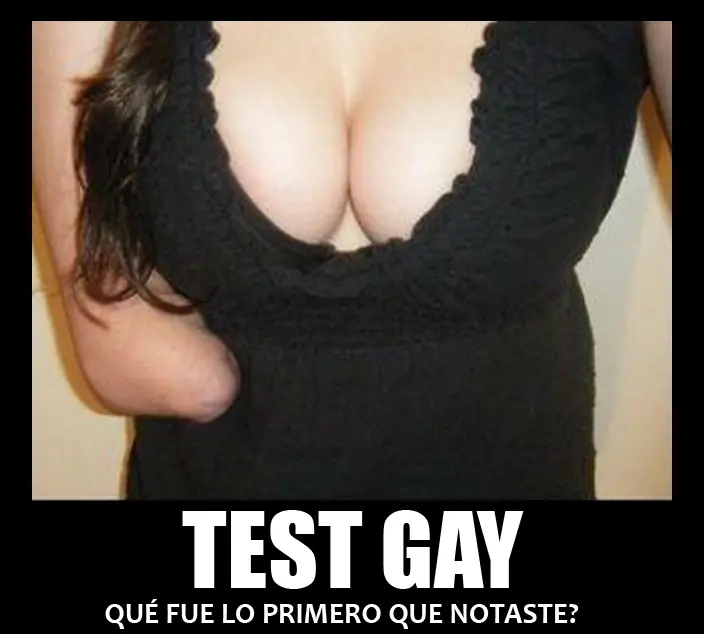 surtido