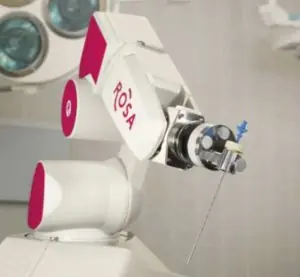Un robot permite operar epilepsias