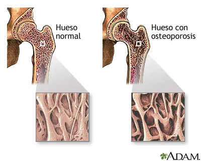 Actividad física en la vida diaria