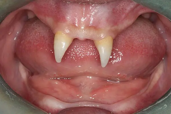 Adolescente chino sorprende por sus dientes de vampiro