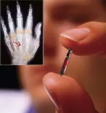 Microchip Implantando en EEUU sera obligatorio para todos