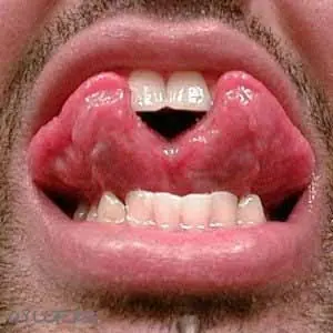 Piercing