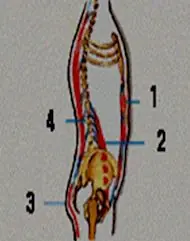 espalda