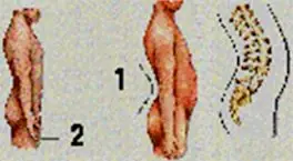 Columna