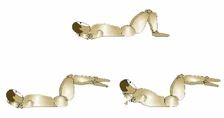 vertebral