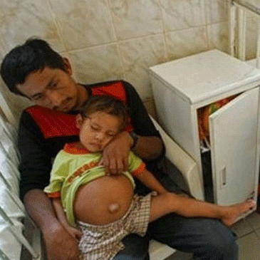 Niño embarazado: Hallan un feto de 700 gramos en su abdomen