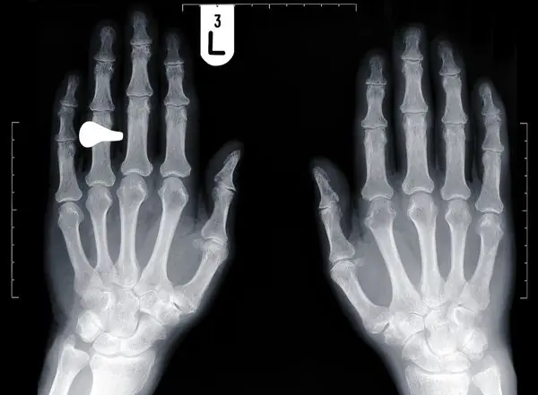 Dime como es tu mano y te dire quien eres