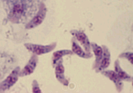 infeccioso
