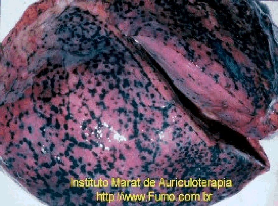 EL cigarro...es un arma ?