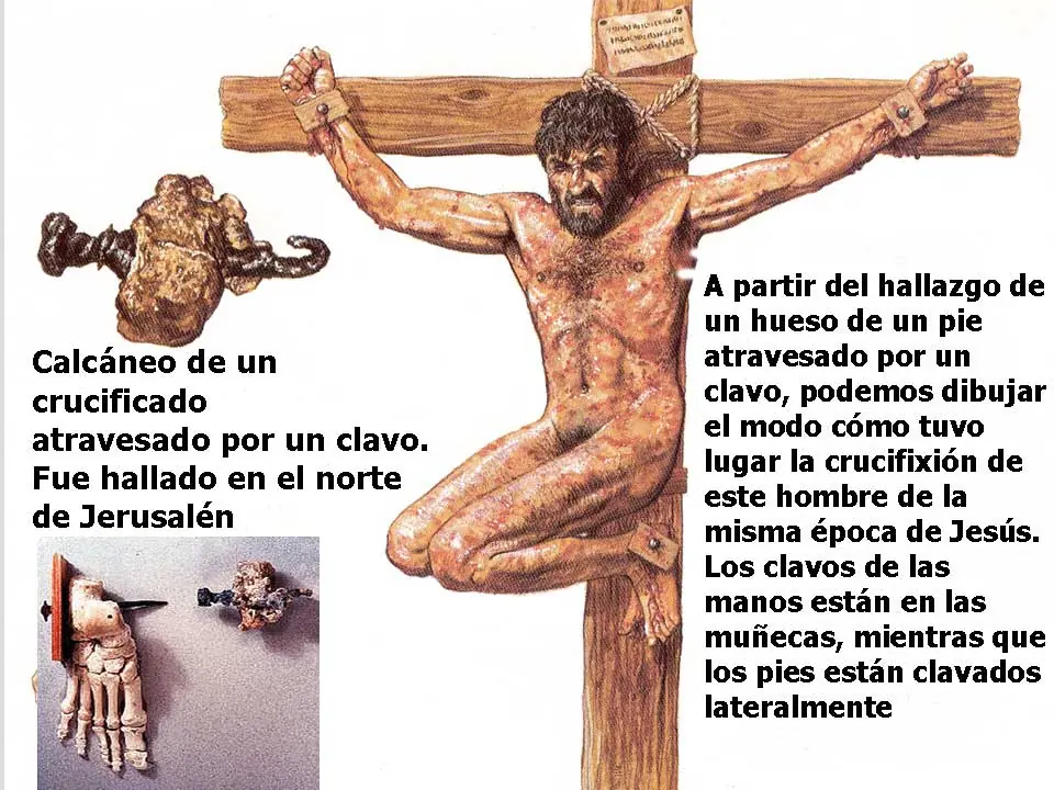 crucifixion