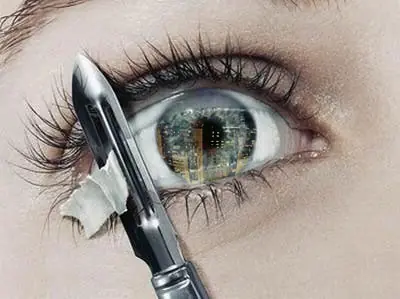 Ojos