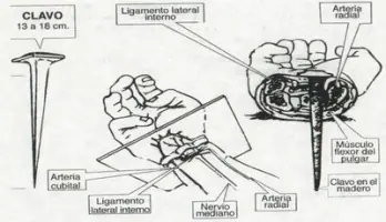 La muerte física de Jesus, analisis forense...