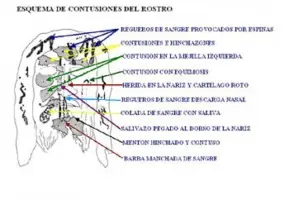 La muerte física de Jesus, analisis forense...