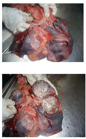 Tomá! Decodifican el código genético de los cánceres