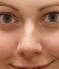 Disminuir Tamaño De Nariz (Con Photoshop Cs3)