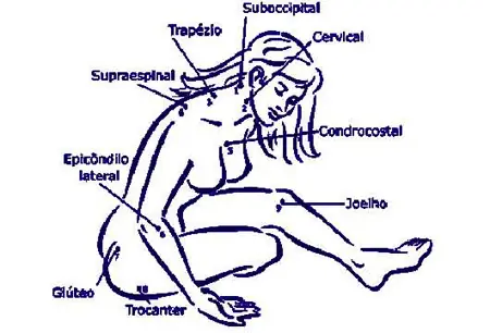 fibromialgia