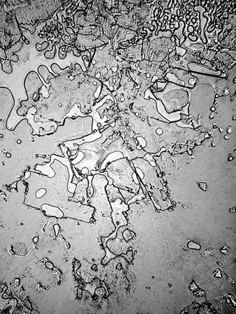 12 fotos de lágrimas bajo un microscopio