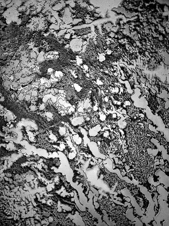 12 fotos de lágrimas bajo un microscopio