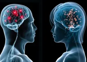 cerebro