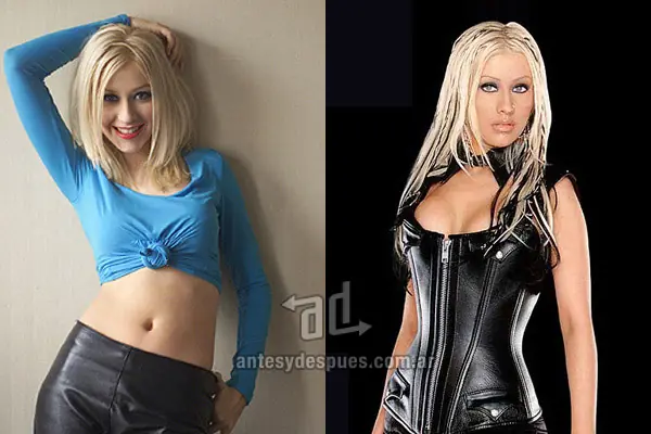 20 Famosas antes y despues del implante