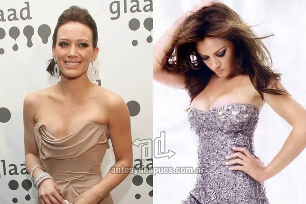 antes y despues