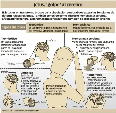 Te enseño "El Codigo Ictus"