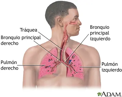 descripcion