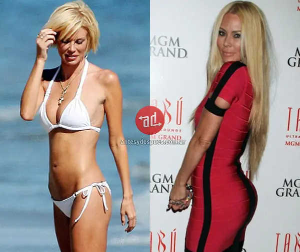 antes y despues