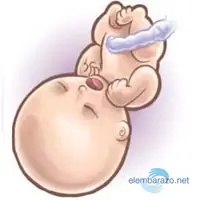 embarazadas