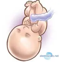 bebe