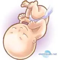 bebe